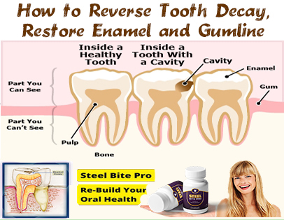 !    How to restore tooth enamel - steel bite pro