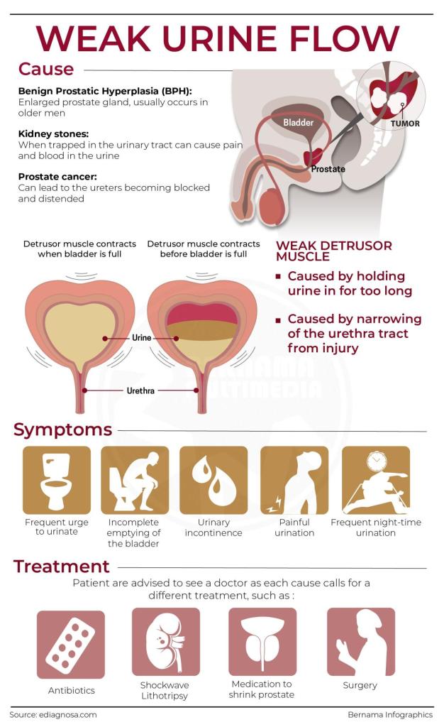 Weak Urine Flow chart pee men » ️Holistic🍊's Timeline Photos » Family